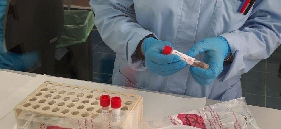 Covid, nessun decesso e 578 nuovi casi in Trentino